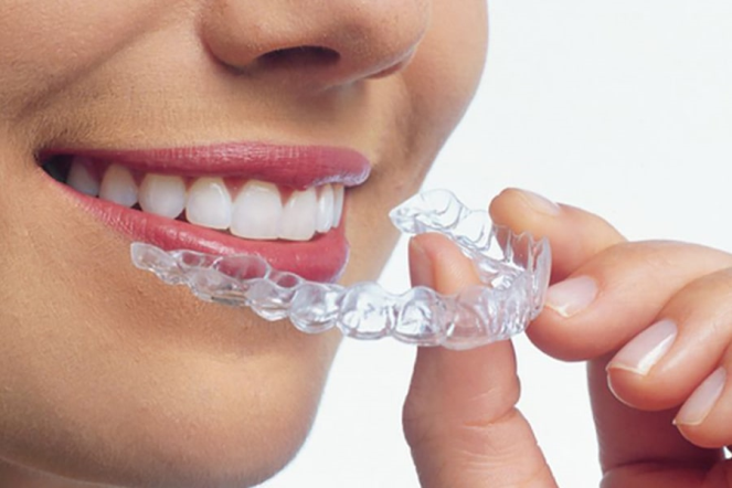 Ortodonti Sürecinde Plak Kullanımı