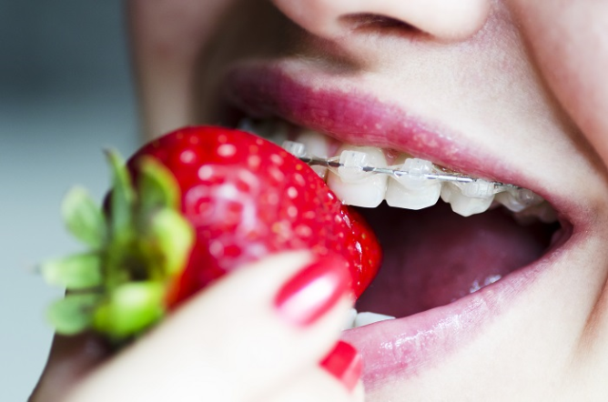 Diş Teli Tedavisinde Beslenme Süreçleri
