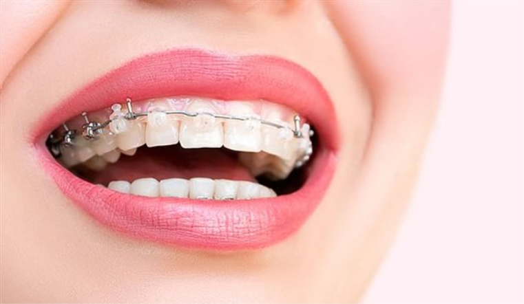 Ortodonti Tedavisinde Kontroller