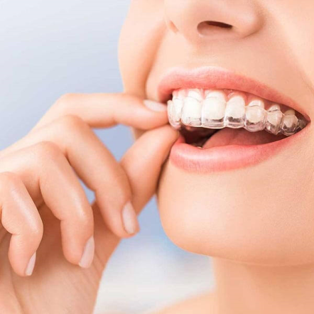 ortodonti tedavi süreci