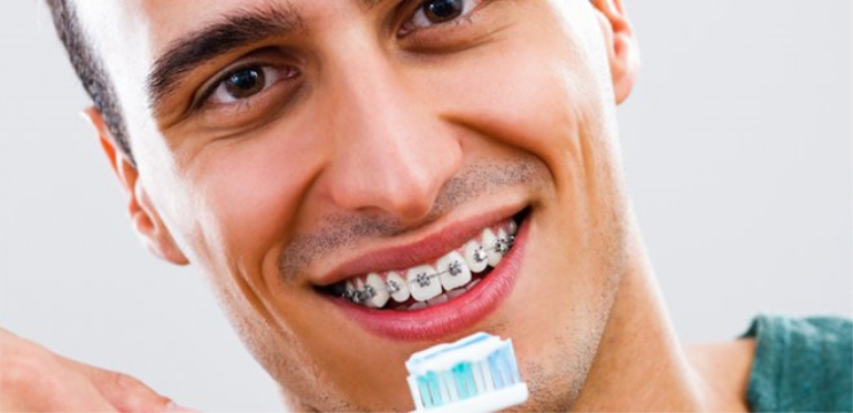 En Güzel Görünüm İçin Diş Teli Tedavisi
