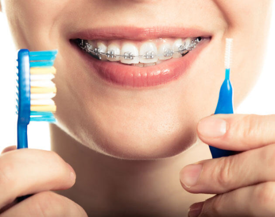 Diş Tedavisinde Bilinecek Detay Noktalar