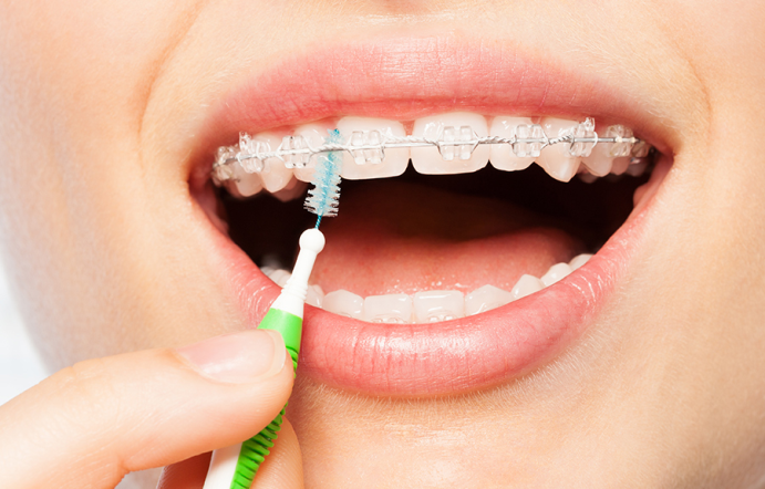 Diş Teli Tedavisi ve Düzenlemeler
