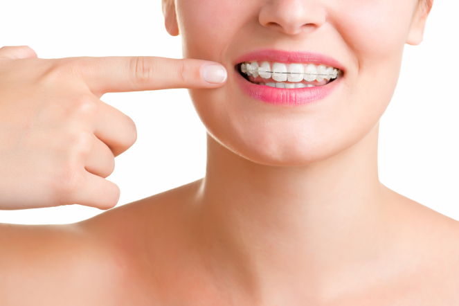 Şeffaf Diş Teli Normal Diş Teli Yerine Kullanılabilir Mi?