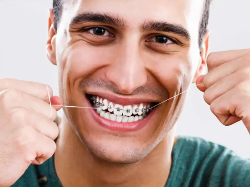CEVAPLARI EN ÇOK MERAK EDİLEN SORULAR