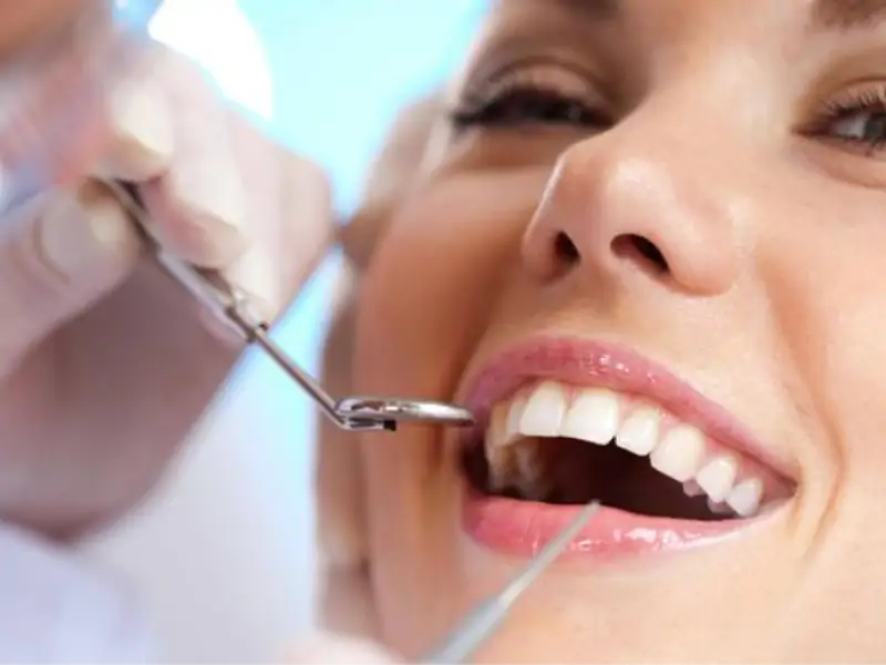 Diş Teli Bakım Sürecinin Önemli Noktaları