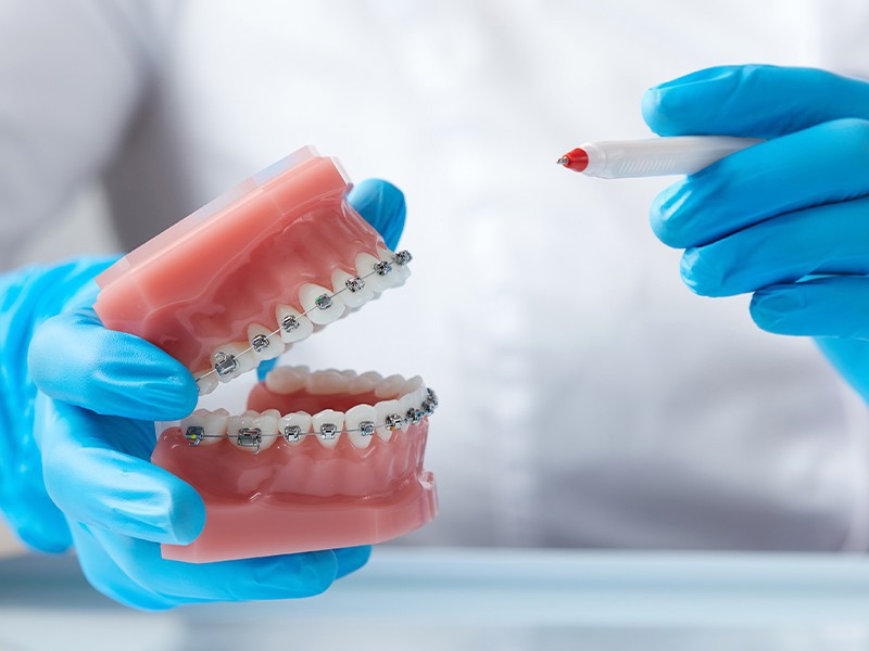 diş teli fiyatları