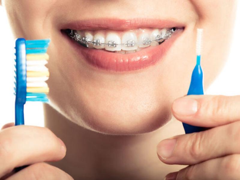 Diş Teli Fiyatları Değerlendirmesi