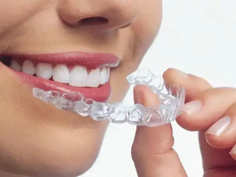 Diş Teli Kullanımı Ardından Plak Kullanılır Mı?