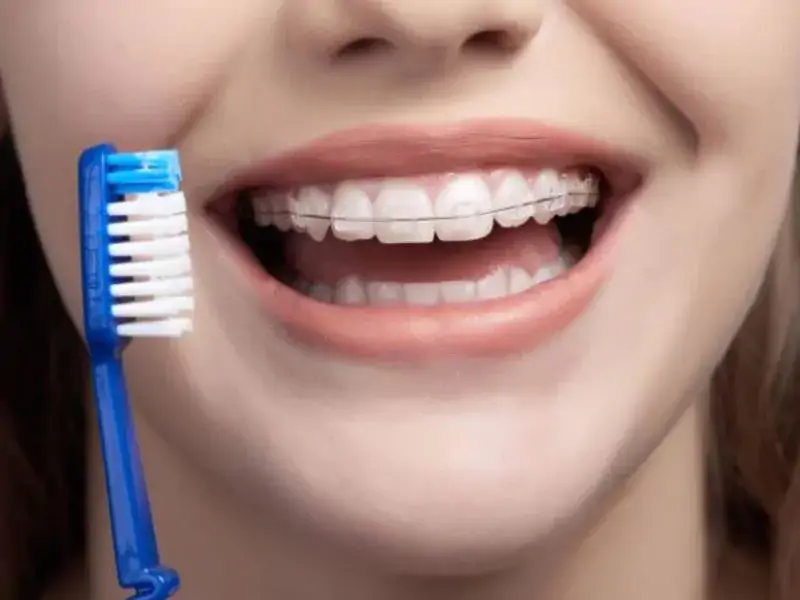 Diş Teli Tedavi Süreçleri