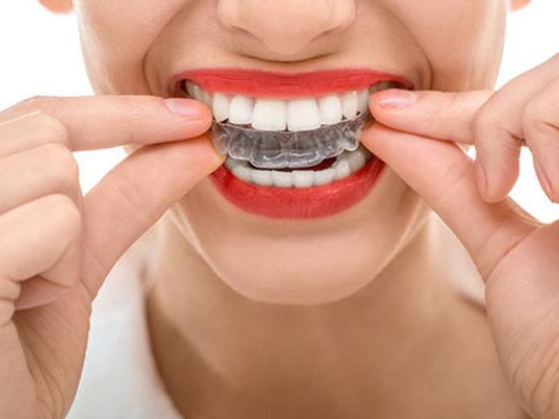 Diş Telinden Sonra Plak Kullanımı