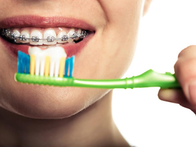 Ortodonti ve Diş Teli Tedavisi Nedir?