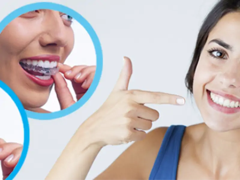 Şeffaf Plaklar Neden Günde En Az 20 Saat Takılmalı?