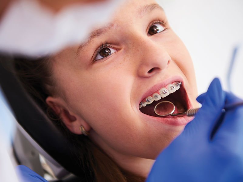 çocuklar için diş teli